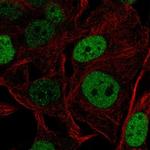 SOX5 Polyclonal Antibody