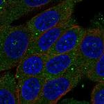 ZSWIM3 Polyclonal Antibody