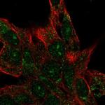 CENPBD1 Polyclonal Antibody