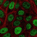 CIRBP Polyclonal Antibody