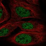 TOPORS Polyclonal Antibody