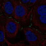 TSSK4 Polyclonal Antibody