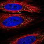 TLL1 Polyclonal Antibody