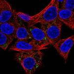 HSD3B7 Polyclonal Antibody