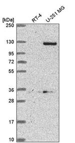 DSEL Antibody in Western Blot (WB)
