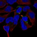 PGM2L1 Polyclonal Antibody