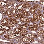 FAM21A Antibody in Immunohistochemistry (Paraffin) (IHC (P))