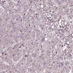 FAM21A Antibody in Immunohistochemistry (Paraffin) (IHC (P))