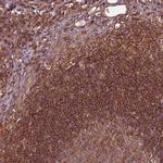 FAM21A Antibody in Immunohistochemistry (Paraffin) (IHC (P))