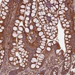 FAM21A Antibody in Immunohistochemistry (IHC)