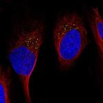 GDF11 Polyclonal Antibody