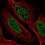 YDJC Polyclonal Antibody