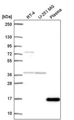 FOXL2NB Antibody in Western Blot (WB)