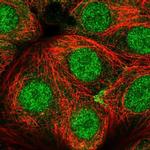 CCDC64 Polyclonal Antibody