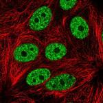 YLPM1 Polyclonal Antibody
