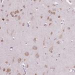 LSM14B Antibody in Immunohistochemistry (Paraffin) (IHC (P))