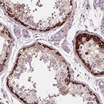 LSM14B Antibody in Immunohistochemistry (IHC)