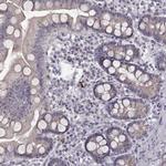 CRB1 Antibody in Immunohistochemistry (Paraffin) (IHC (P))