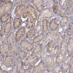 CRB1 Antibody in Immunohistochemistry (Paraffin) (IHC (P))
