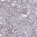 CRB1 Polyclonal Antibody