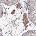 CRB1 Antibody in Immunohistochemistry (Paraffin) (IHC (P))