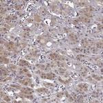 CRB1 Antibody in Immunohistochemistry (IHC)