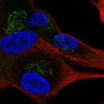 APBA1 Polyclonal Antibody