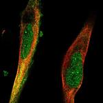 TRIM36 Polyclonal Antibody