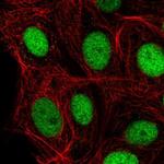 C14orf4 Polyclonal Antibody