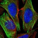 CSGALNACT1 Polyclonal Antibody