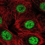 SMARCD2 Polyclonal Antibody