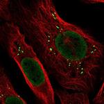 ARHGAP25 Polyclonal Antibody