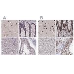 SR140 Polyclonal Antibody