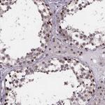 SR140 Antibody in Immunohistochemistry (IHC)