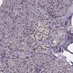 SR140 Antibody in Immunohistochemistry (IHC)