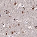 SR140 Antibody in Immunohistochemistry (IHC)