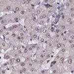 SR140 Antibody in Immunohistochemistry (IHC)