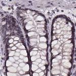 SR140 Antibody in Immunohistochemistry (IHC)