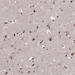 SR140 Antibody in Immunohistochemistry (IHC)
