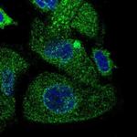 TMEM230 Antibody in Immunocytochemistry (ICC/IF)