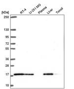TMEM230 Antibody in Western Blot (WB)