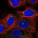 VPS51 Polyclonal Antibody