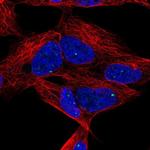 DLX6 Polyclonal Antibody