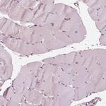 IKBIP Antibody in Immunohistochemistry (Paraffin) (IHC (P))