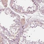 IKBIP Polyclonal Antibody