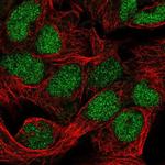 FAM208B Antibody in Immunocytochemistry (ICC/IF)