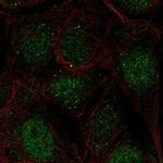 CCDC63 Polyclonal Antibody