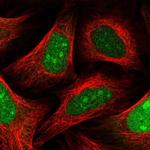 SLBP Polyclonal Antibody