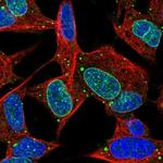 KIAA1614 Polyclonal Antibody