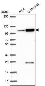 KIAA1614 Antibody in Western Blot (WB)